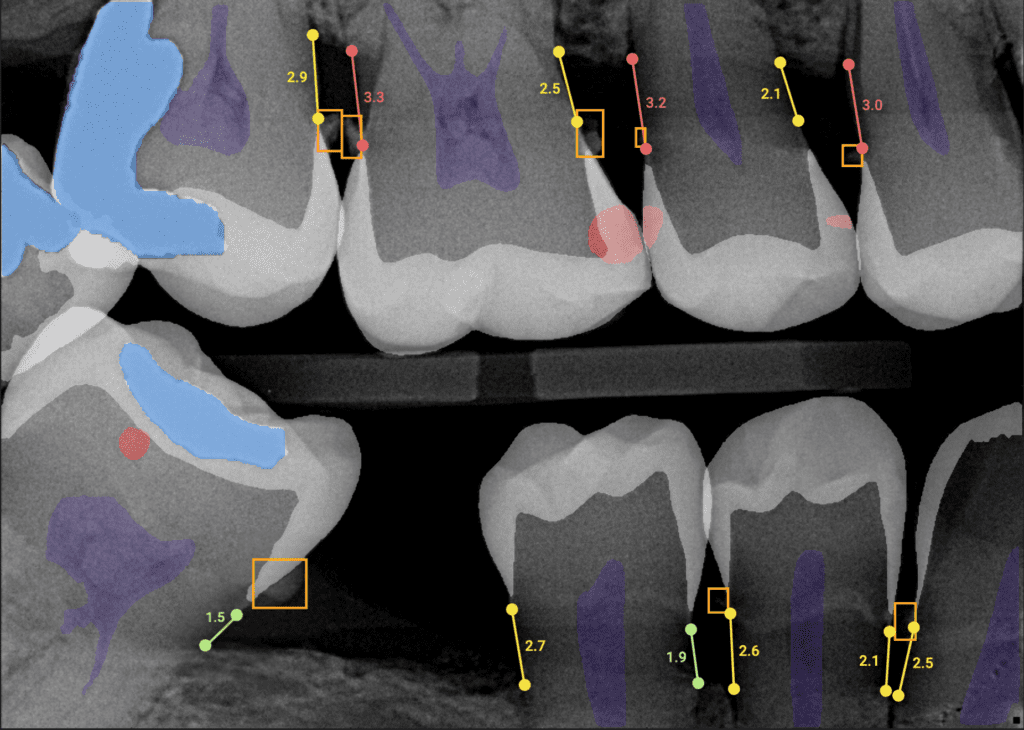 overjet ai dentist in annapolis md